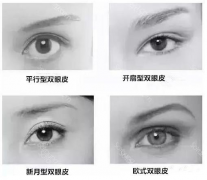 新氧App：欧式双眼皮让你秒变“大眼芭比