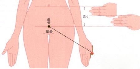 拔罐按摩针灸  日常养生必知的6大穴位