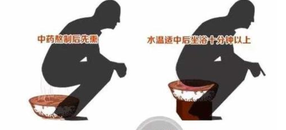 坐浴对男性有什么好处 保护生殖器需要也需要技巧