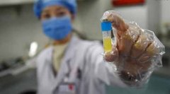 自测 看看你的精液是否健康