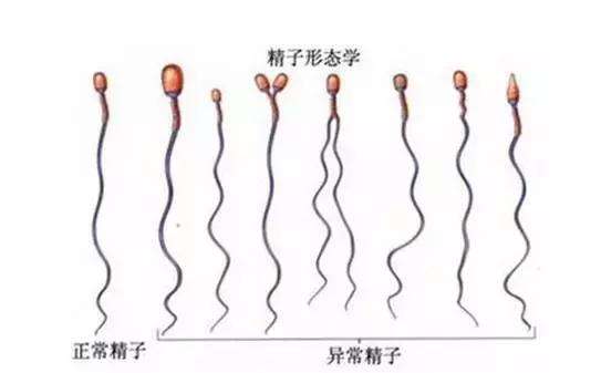 自测 看看你的精液是否健康