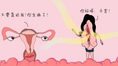 容易引发女人阴道炎的三件事