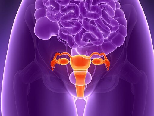 女性不孕大敌——子宫内膜异位